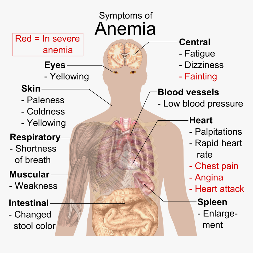 Symptoms Of Anemia - Know If You Re Anemic, HD Png Download, Free Download