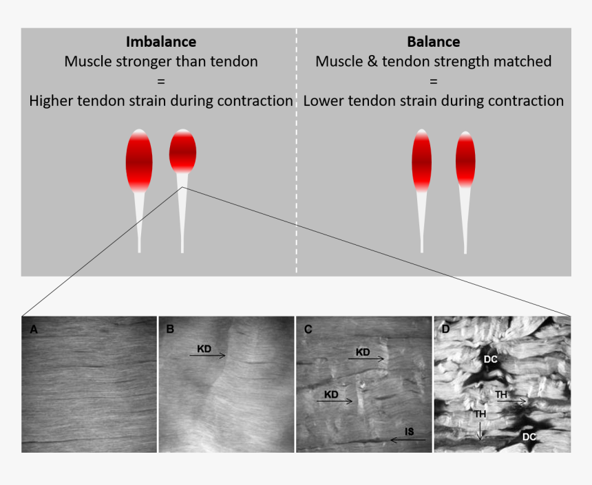 Increased Tendon Strength, HD Png Download, Free Download