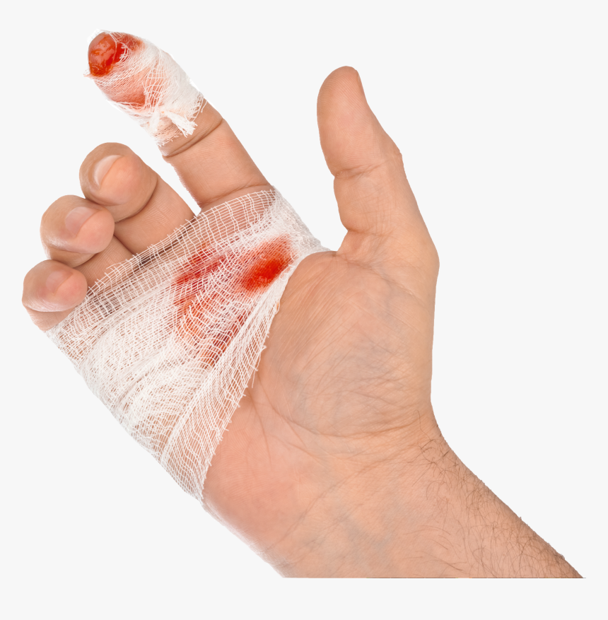 Steel Doctor Blade Injury Cut - Hand With Blood Png, Transparent Png, Free Download