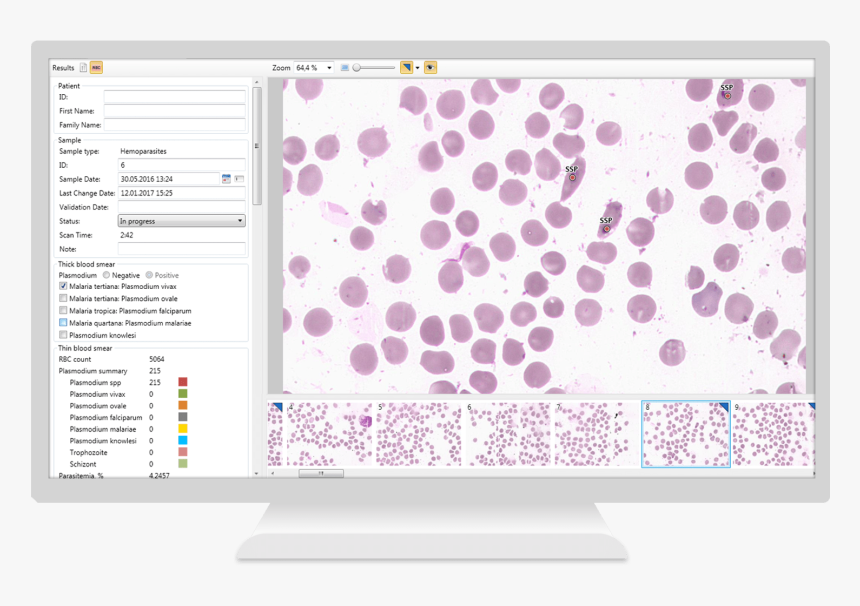 Vision Hema® Malaria Analysis Of Malaria, HD Png Download, Free Download