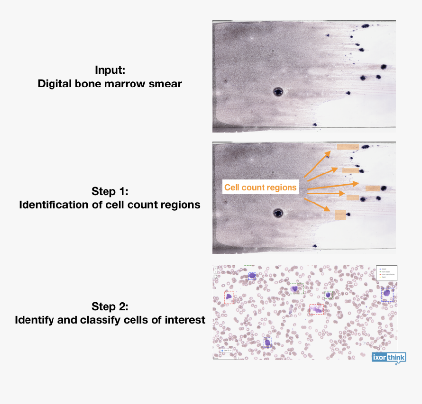 Blood Smear Png, Transparent Png, Free Download