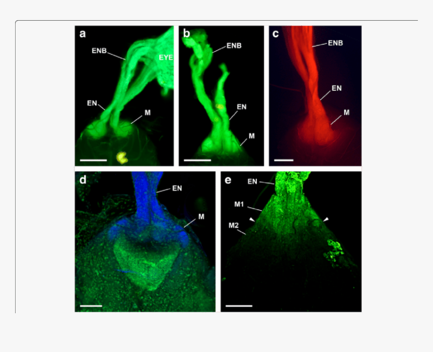 Medical Imaging, HD Png Download, Free Download