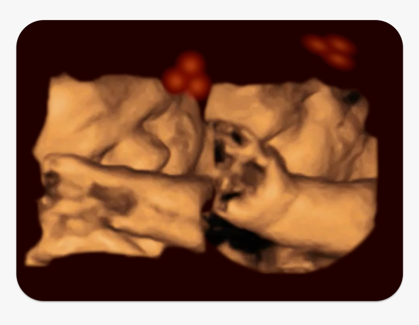 4d Fetus - Kirsty Dunn Fetus, HD Png Download, Free Download