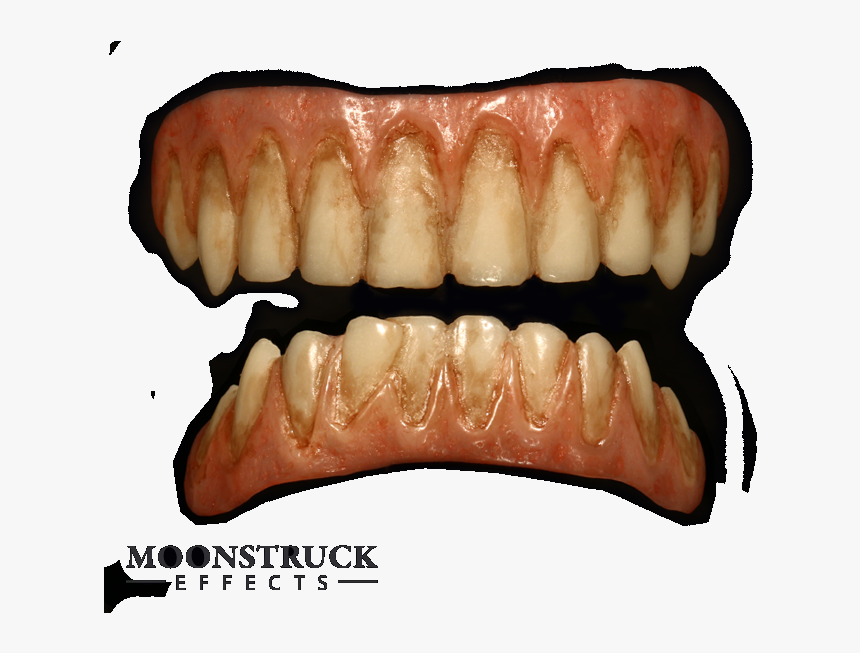 Tooth, HD Png Download, Free Download