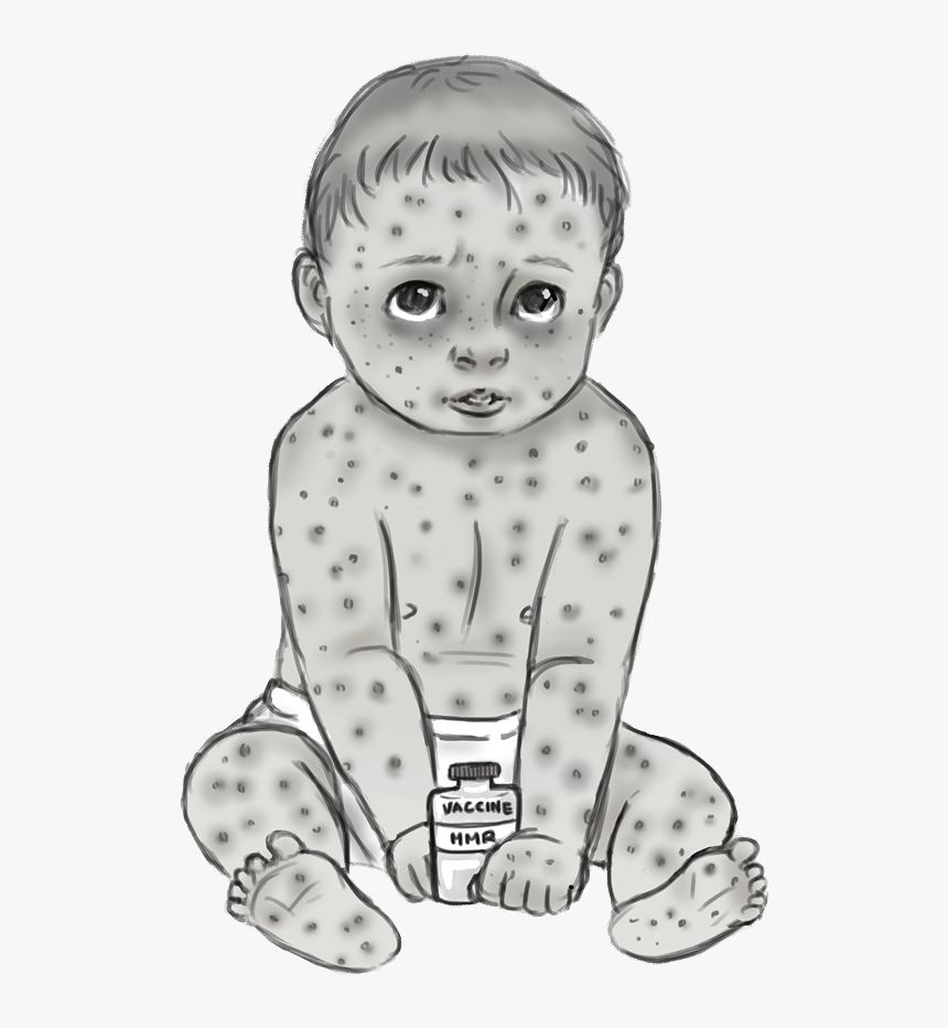 Measles Transparent, HD Png Download, Free Download