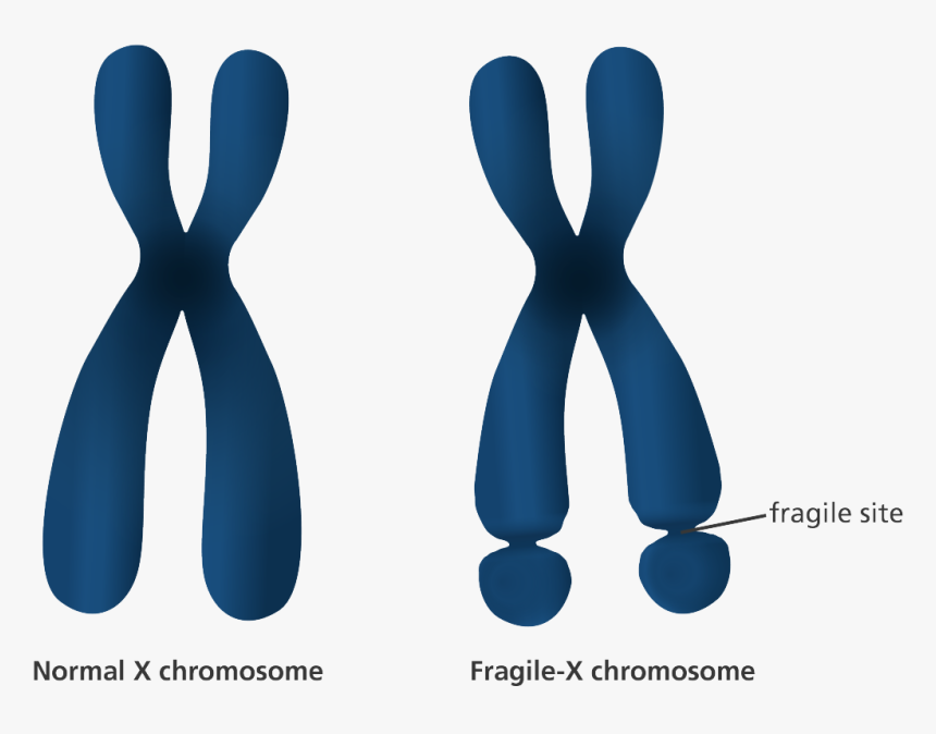 Fragile X syndrome - Causes of Disabilities