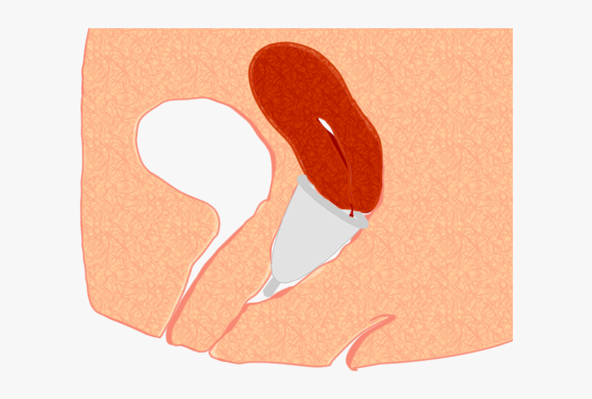 Menstrual Cup Pos3 - Tilted Uterus Menstrual Cup, HD Png Download, Free Download