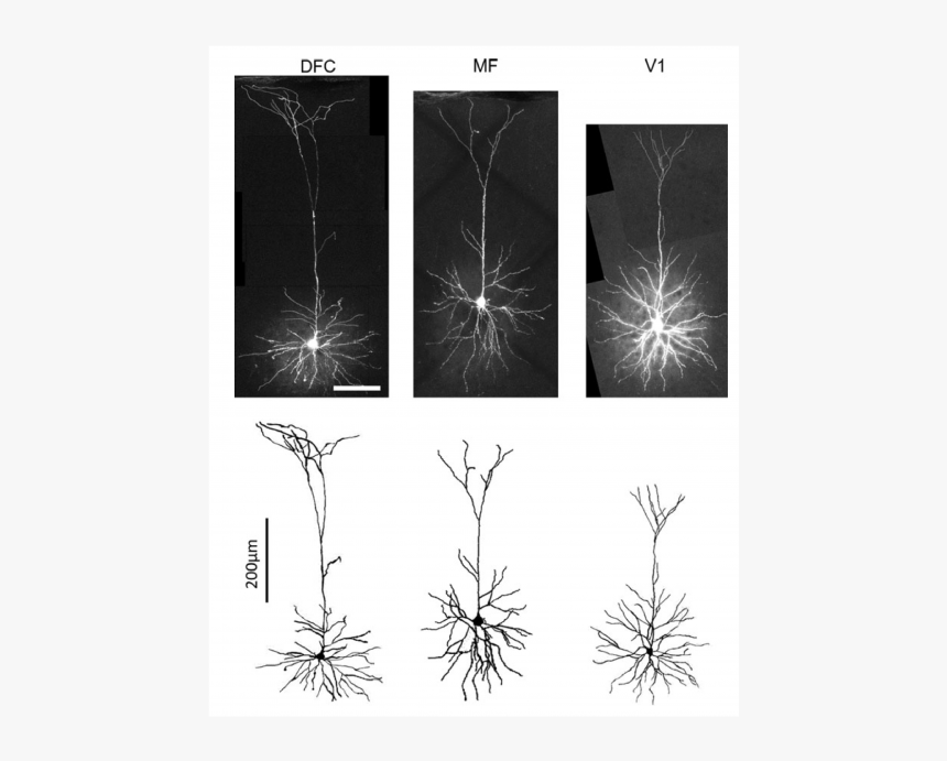 Pyramidal Neuron, HD Png Download, Free Download