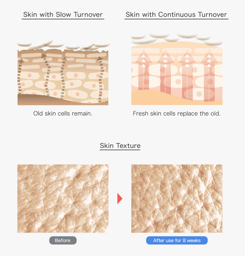 Skin Turnover, HD Png Download, Free Download