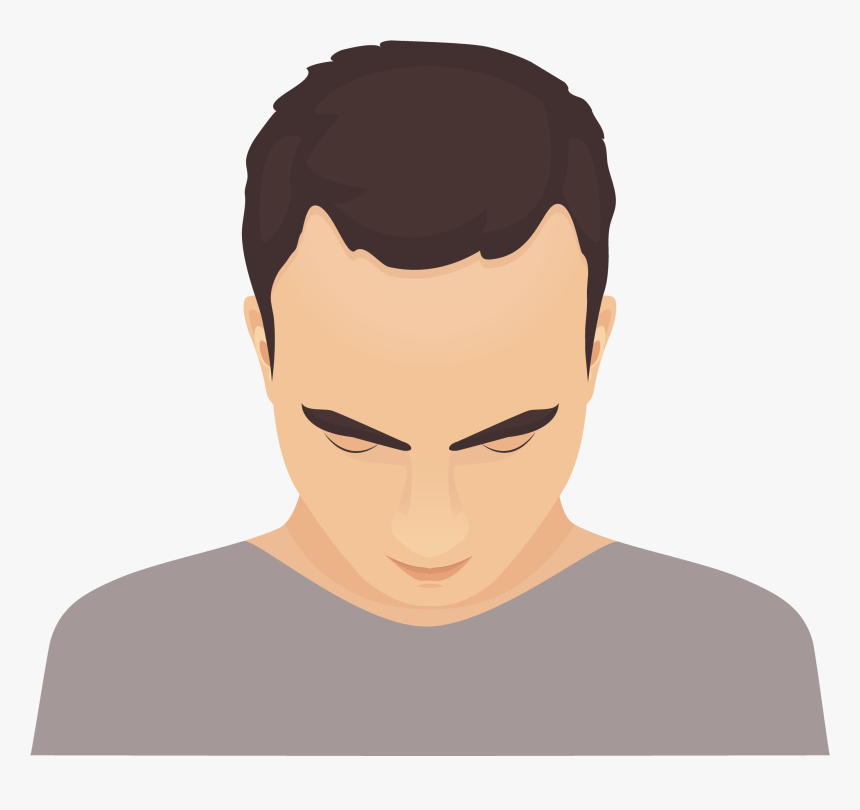 Png Baldness, Transparent Png, Free Download