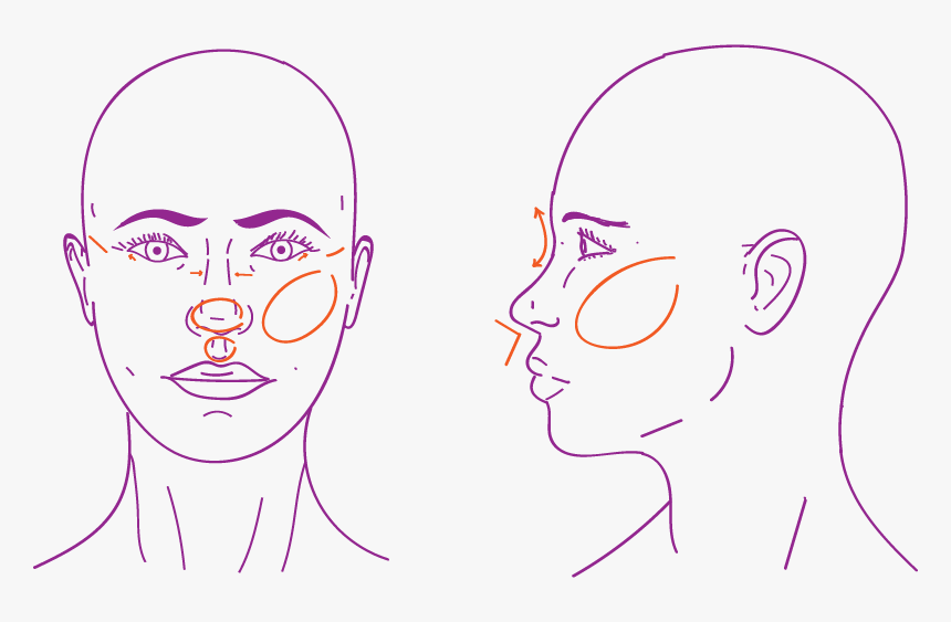 Middle Face Procedures In Facial Feminization Surgery - Temple Area Of Face, HD Png Download, Free Download