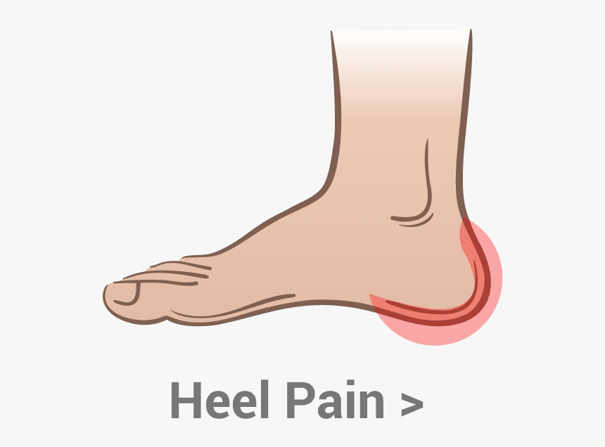 Heel-pain - Ball Of Foot Pain, HD Png Download, Free Download