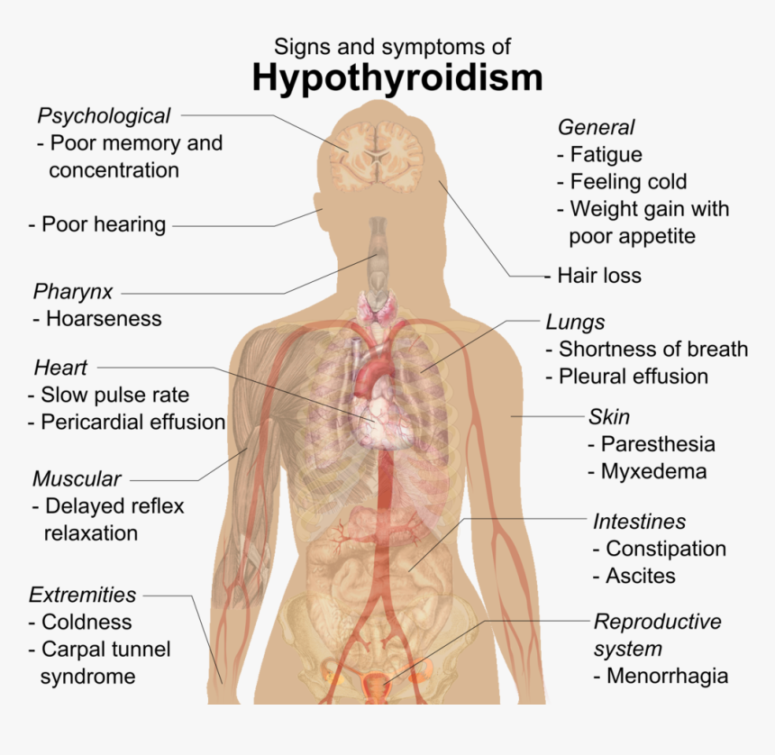 Effect Of Hypothyroidism, HD Png Download, Free Download