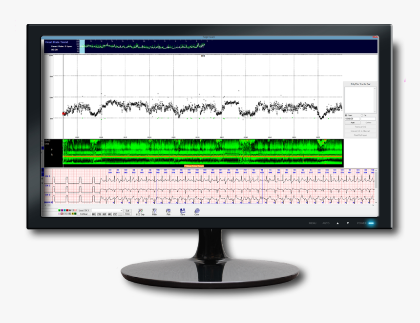 Heart Rate Trending - Computer Monitor, HD Png Download, Free Download