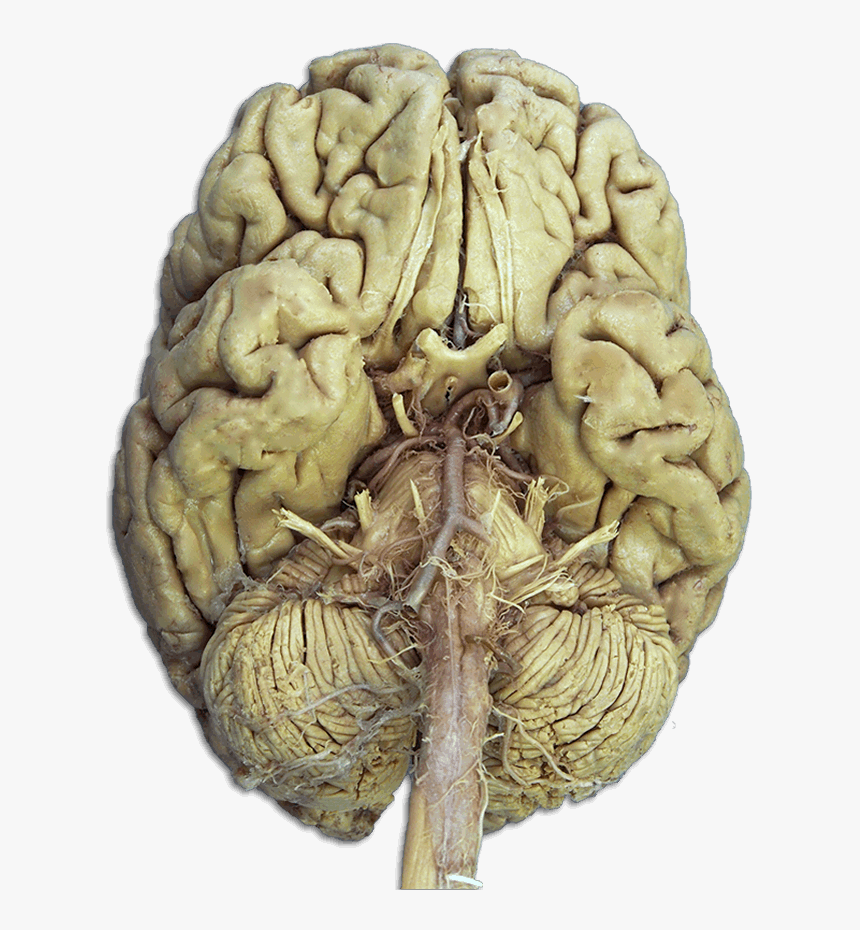 Cranial Nerves On Brain Cadaver - Cranial Nerves On The Brain, HD Png Download, Free Download