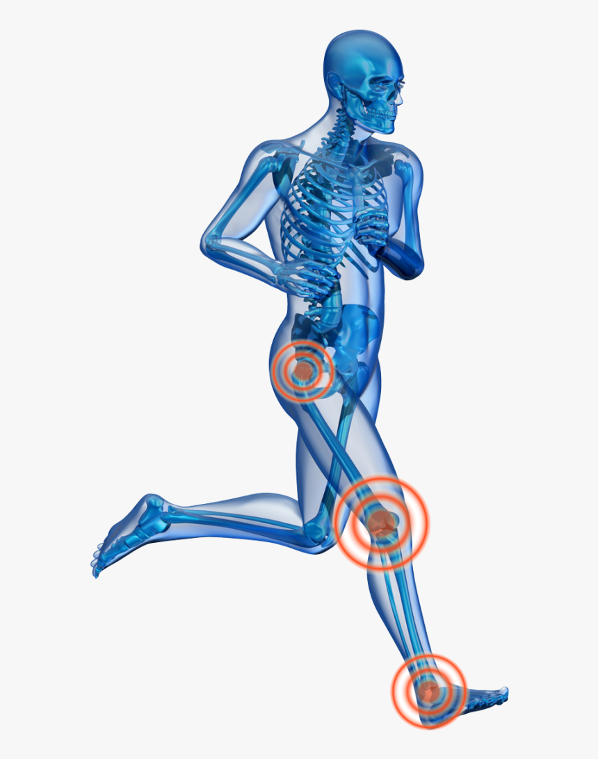 3 Causes Of Knee Pain - Man Running X Ray, HD Png Download, Free Download