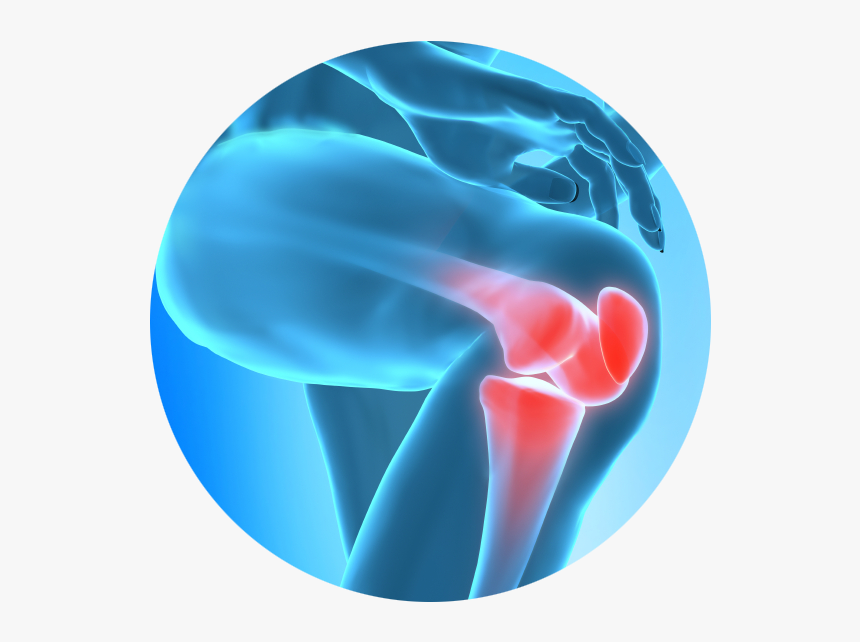 Chronic Joint Pain Slowing You Down Learn How Regenerative - Knee Pain Png, Transparent Png, Free Download