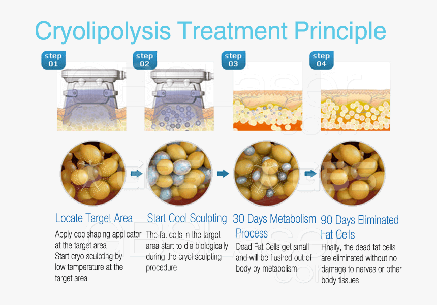 Fat Cell Cavitation, HD Png Download, Free Download