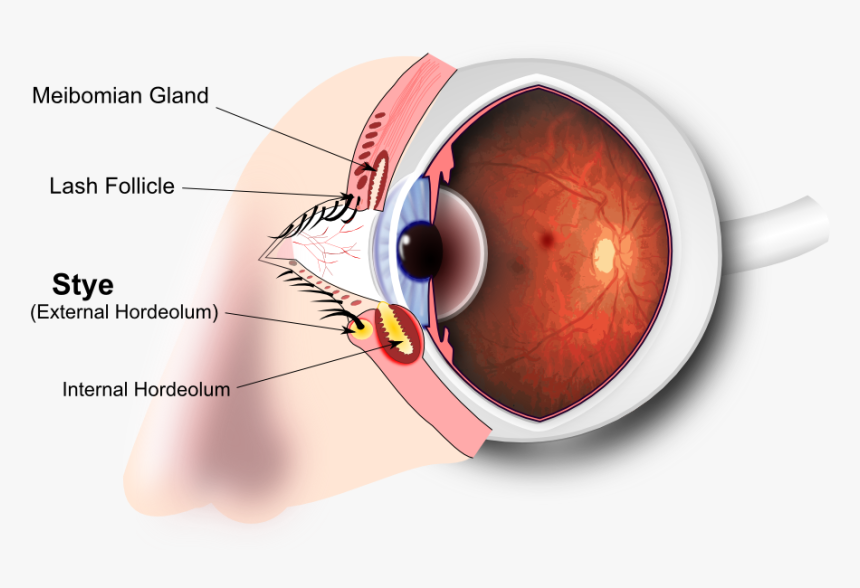 Eye - Eye Stye Diagram, HD Png Download, Free Download