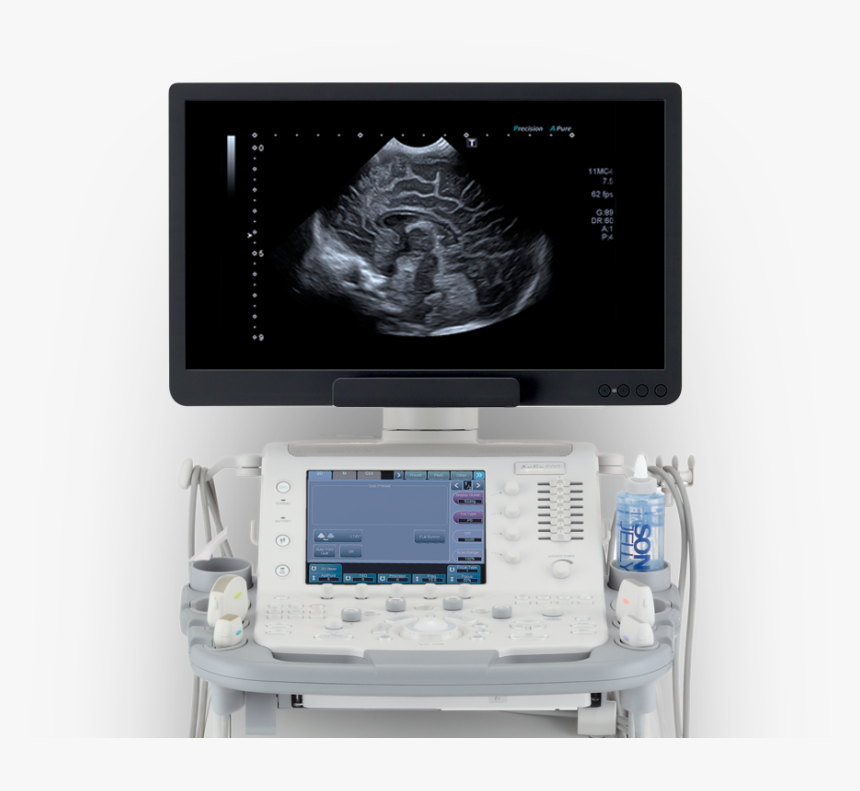 Ultrasonography, HD Png Download, Free Download