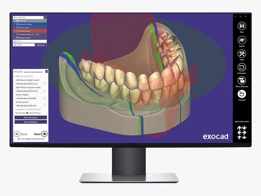 Automatically Suggested Tooth Setup - Exocad 2017, HD Png Download, Free Download