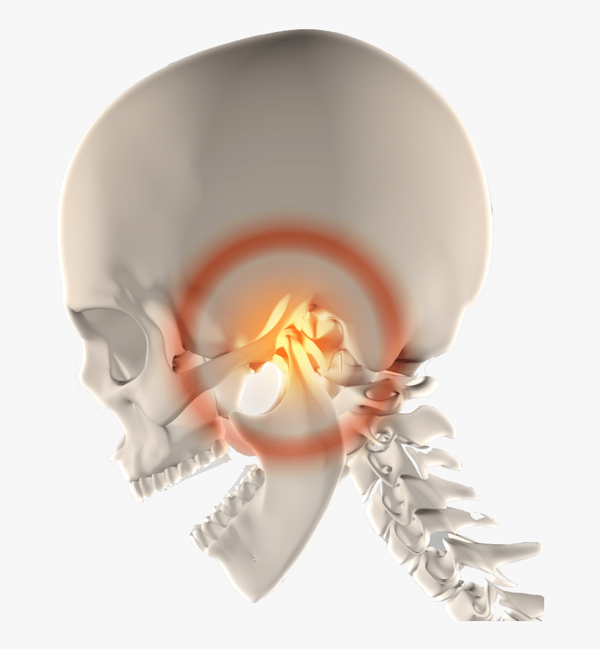 Tmj Therapy Tmj Pain Jaw Pain Florence Sc Tmj Dentist - Jaw Cramp, HD Png Download, Free Download