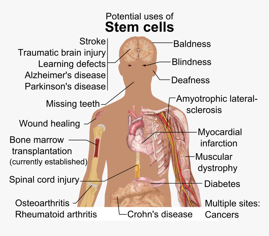 Stem Cell Treatments - Can Stem Cells Be Used, HD Png Download, Free Download