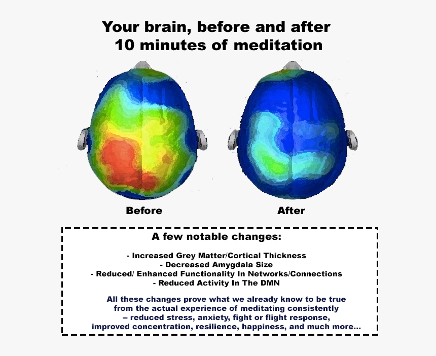 A Few Notable Changes - Brain Before And After Drinking, HD Png Download, Free Download