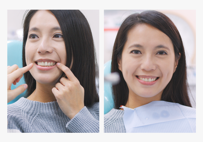 Patient Smiling After Functional Crown Lengthening, HD Png Download, Free Download