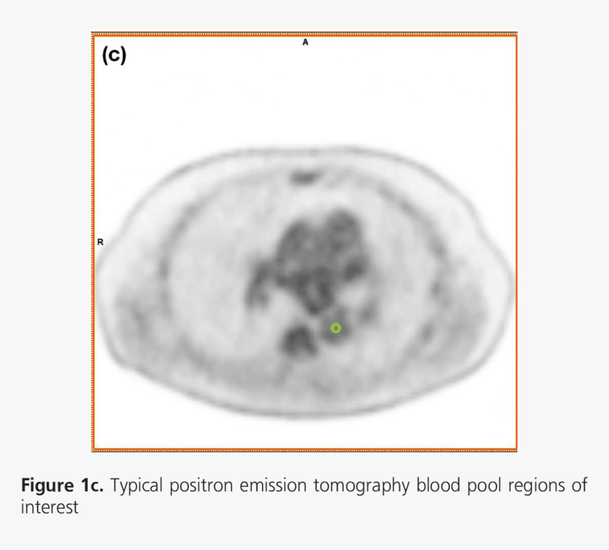 Computed Tomography, HD Png Download, Free Download