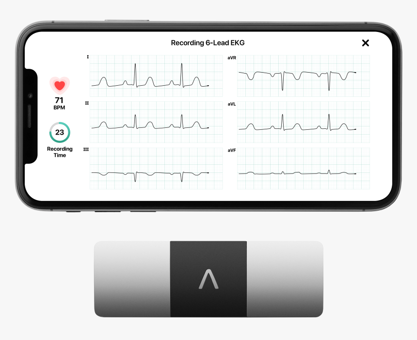 Diagram, HD Png Download, Free Download