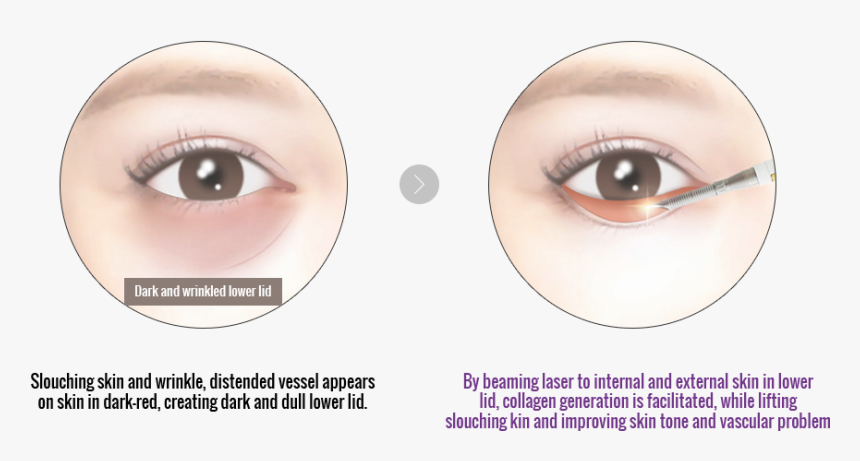 Eyelash Extensions, HD Png Download, Free Download