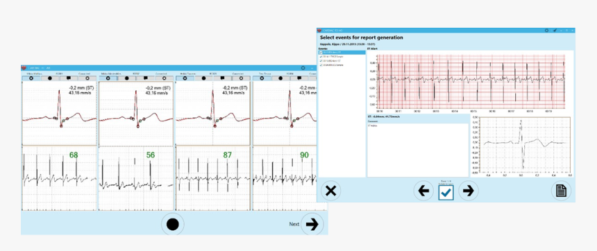 Picture - Ecg For Cardiac Rehab, HD Png Download, Free Download