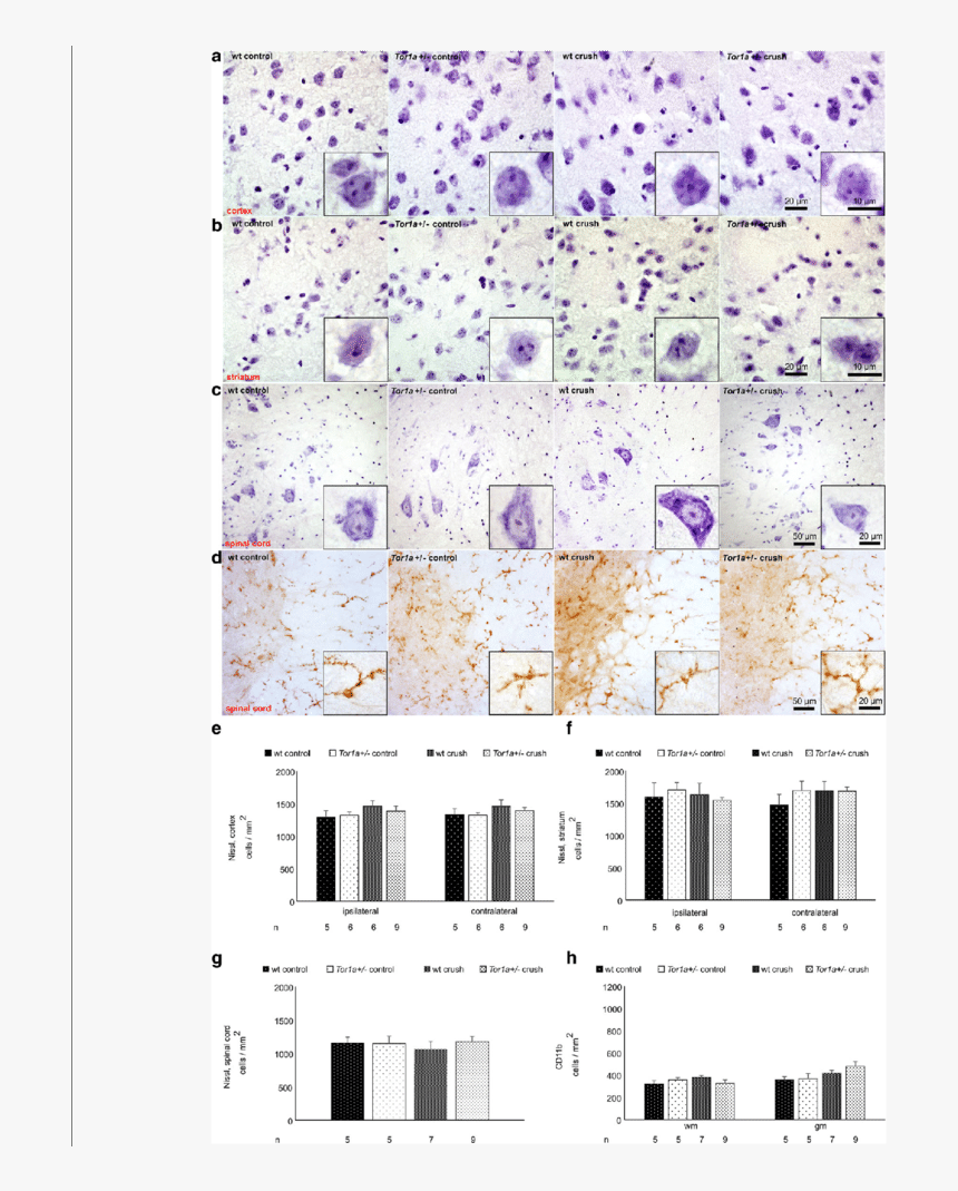 Tor1a / Mice Do Not Present Morphological Changes In - Architecture, HD Png Download, Free Download