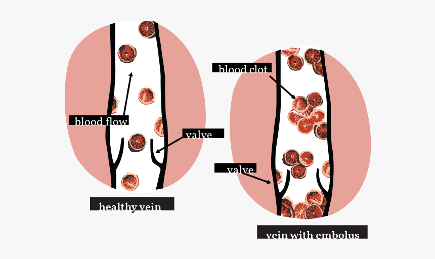 Dvt Web Full - Circle, HD Png Download, Free Download