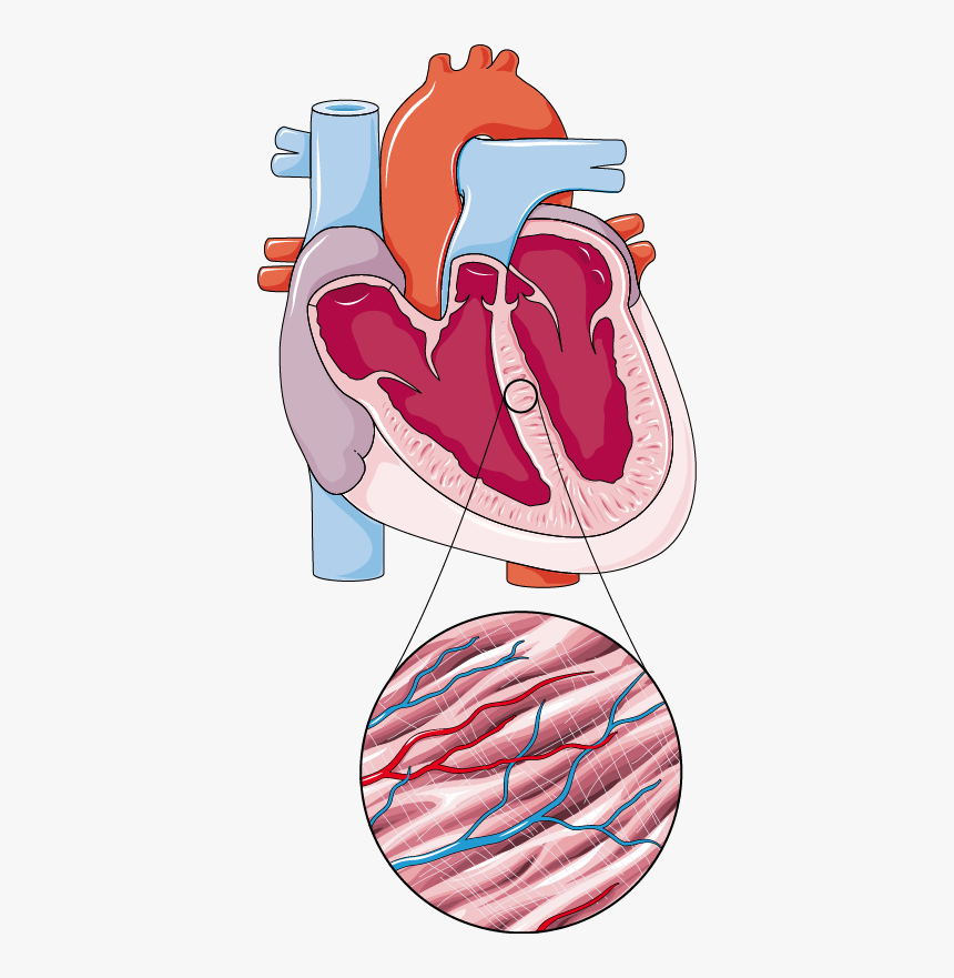 Coeur A - Hypoplastic Left Heart Syndrome Anatomy, HD Png Download, Free Download