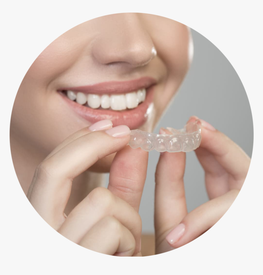 Invisalign-woman 196892522 - Clear Aligners, HD Png Download, Free Download