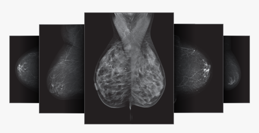 Densitas Breast Scan - Radiology, HD Png Download, Free Download