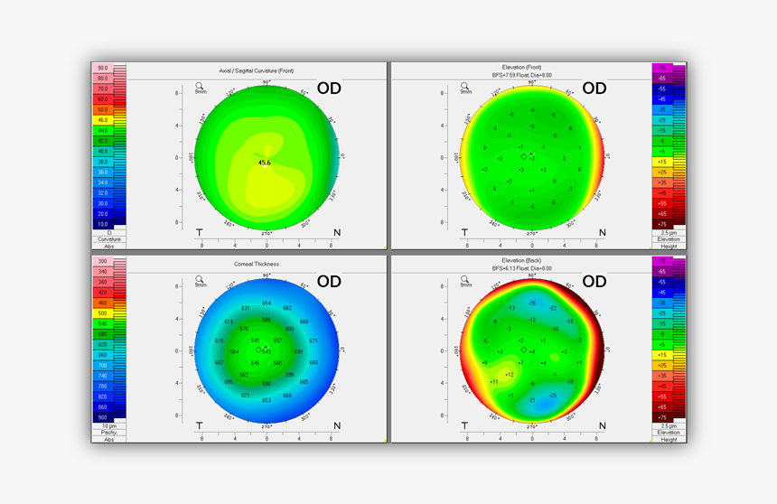 4 Maps Refactive Of The Stable Right Eye - Circle, HD Png Download, Free Download