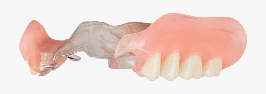 Flexible Upper Partial Denture, HD Png Download, Free Download