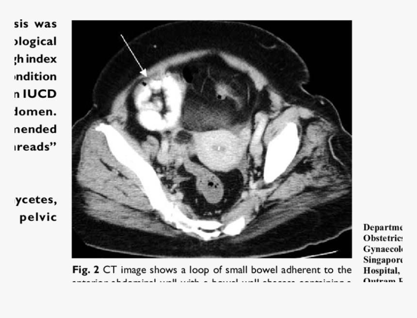 Computed Tomography, HD Png Download, Free Download