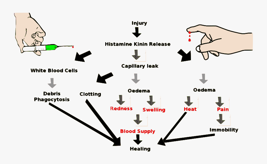 Inflammation Clipart Icon Png - Inflammation Scheme, Transparent Png, Free Download