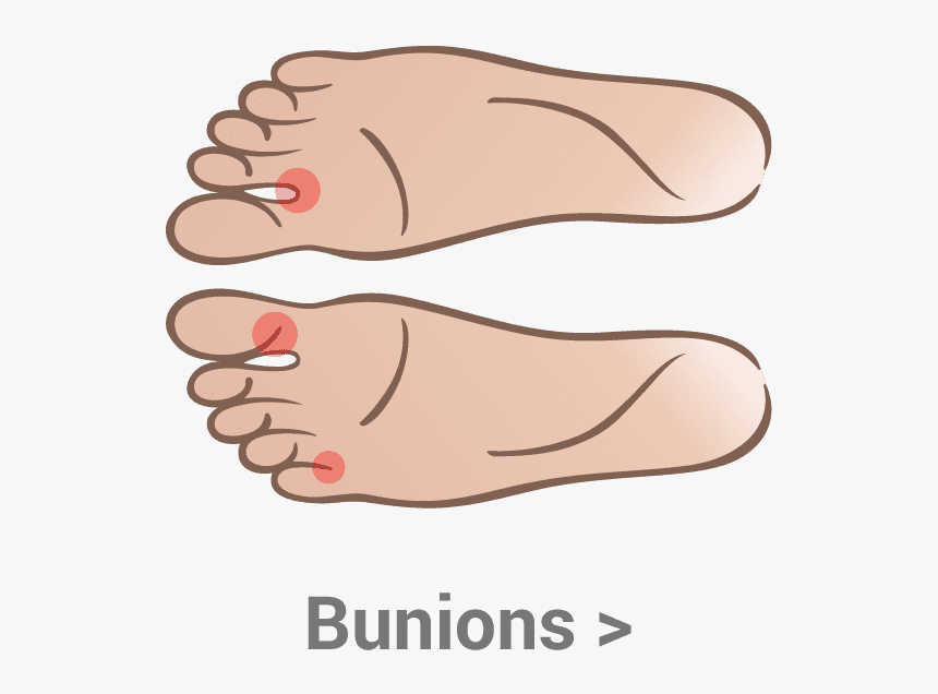 bunions-bump-under-big-toe-joint-hd-png-download-kindpng