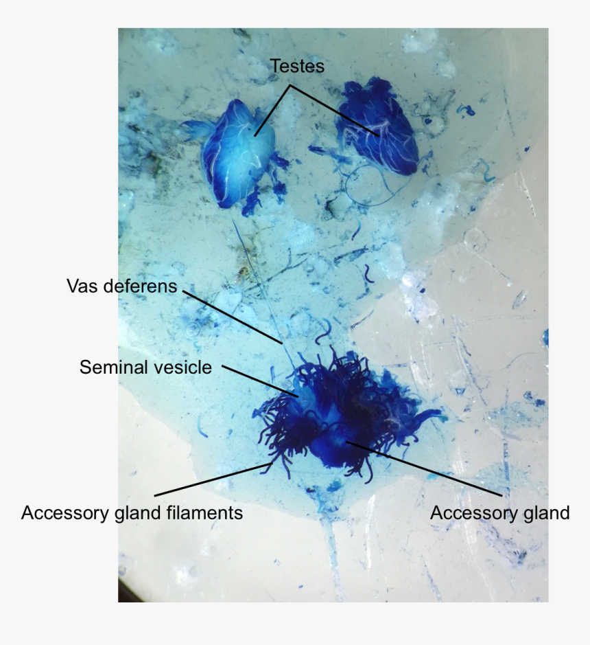 - Male Reproductive System Of Locust , Png Download - Locust Testes, Transparent Png, Free Download