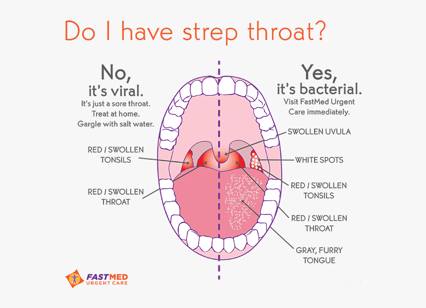 Strep Throat Symptoms, HD Png Download, Free Download