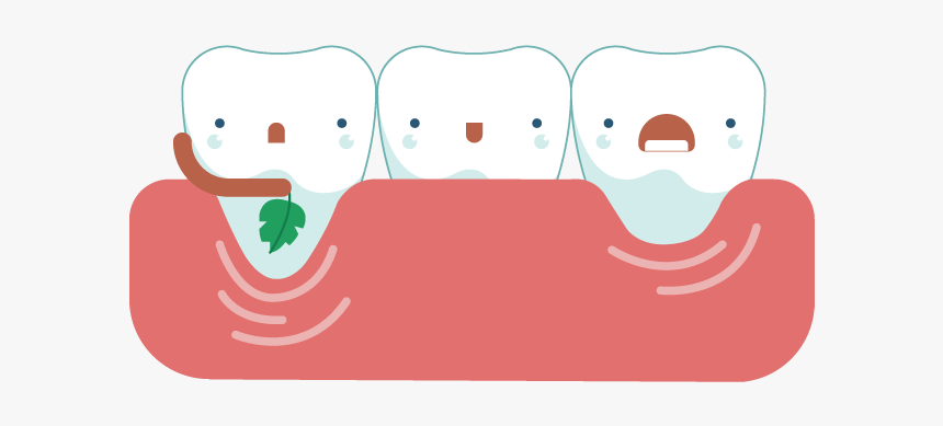 Receding Solutions Pinhole Surgical - Receding Gums Clipart, HD Png Download, Free Download