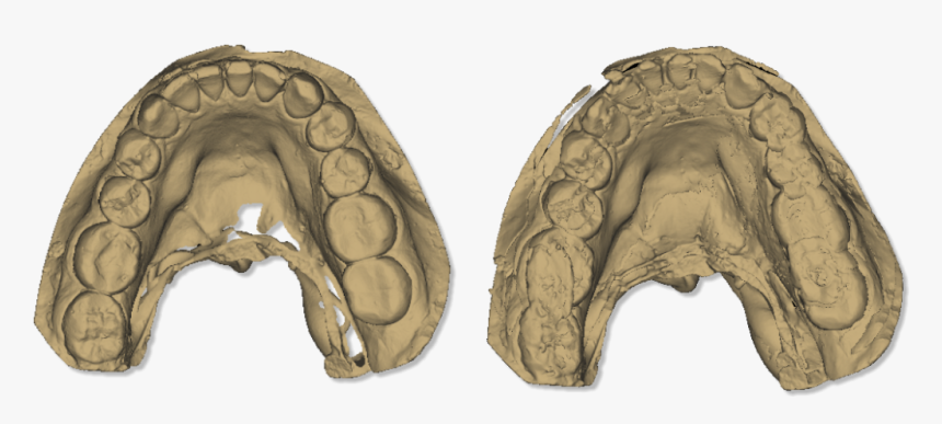 Dental Scanner 3d, HD Png Download, Free Download