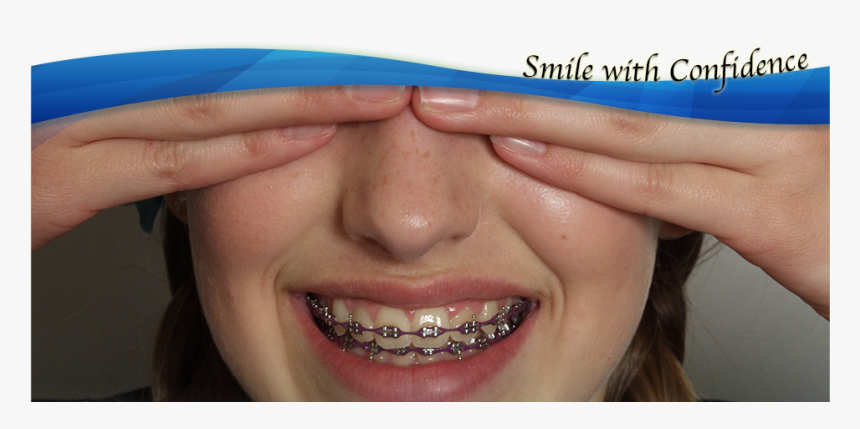 Life With Braces - Braces Teeth For Athletes, HD Png Download, Free Download