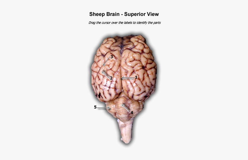 Labeled Superior View Of Real Brain, HD Png Download, Free Download