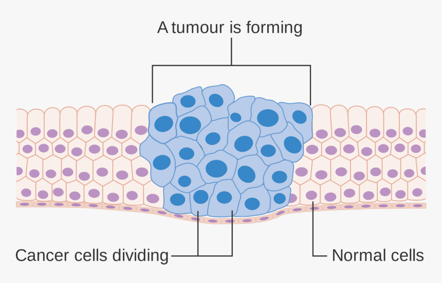 Cancer Diagram, HD Png Download, Free Download